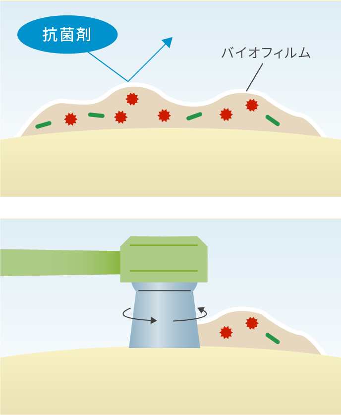 PMTCだからできること