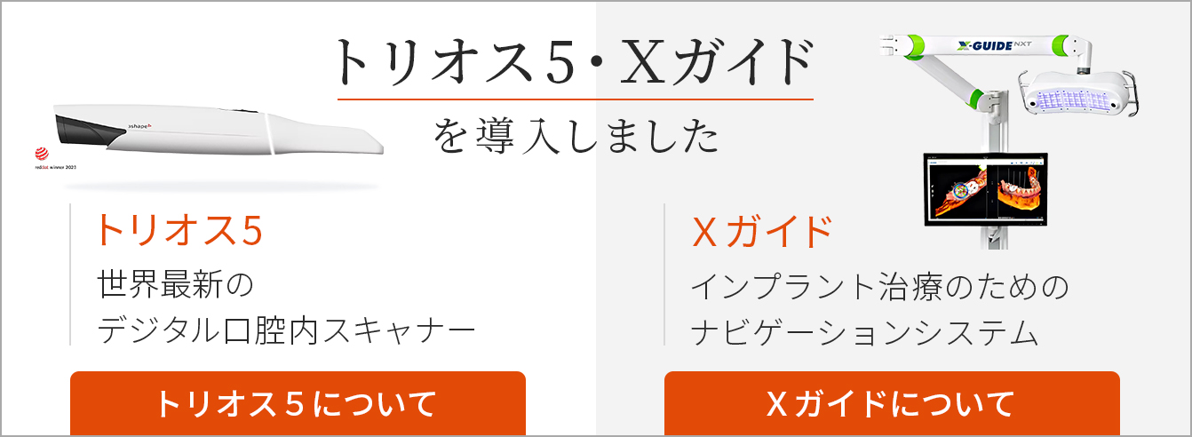 トリオス・Xガイド