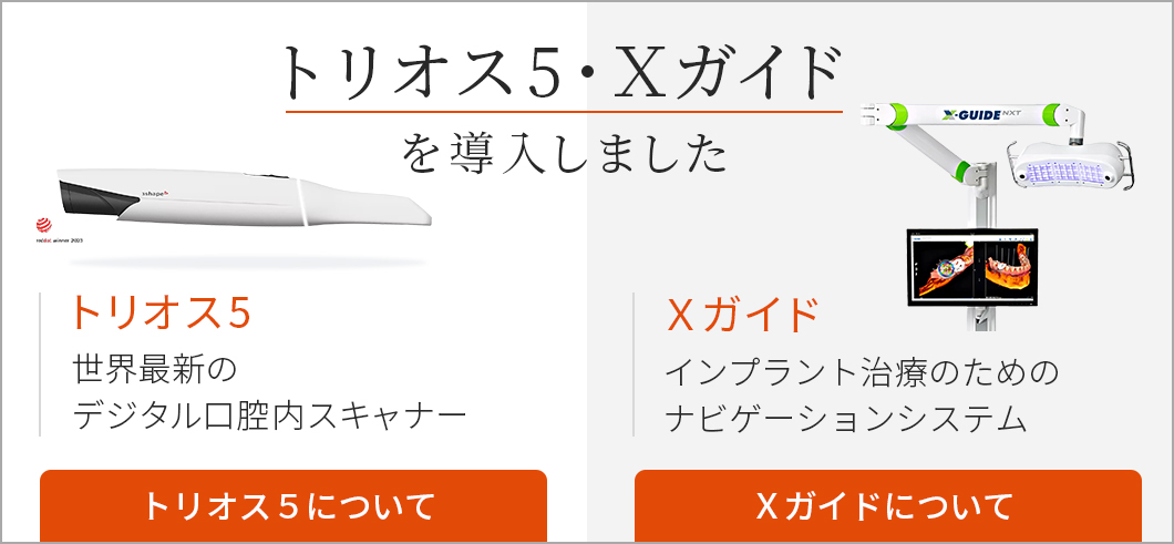 トリオス・Xガイド