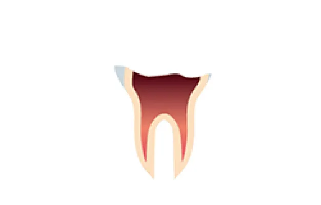 C4