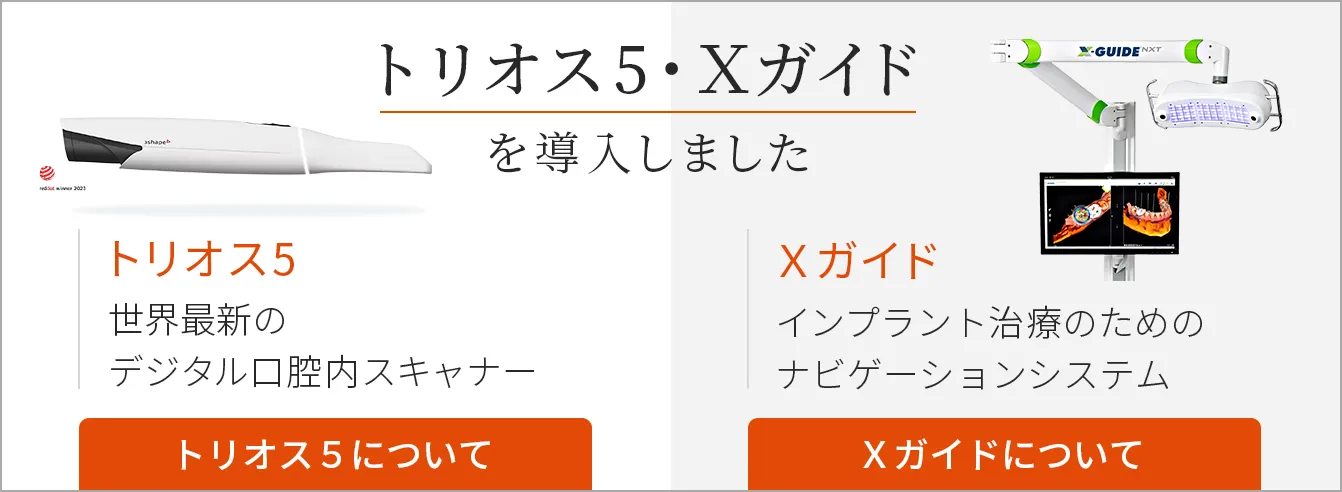 トリオス・Xガイド