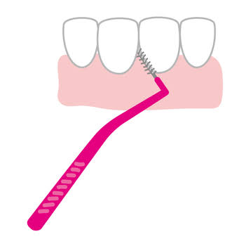 歯間ブラシについてのお話　2023.7.6