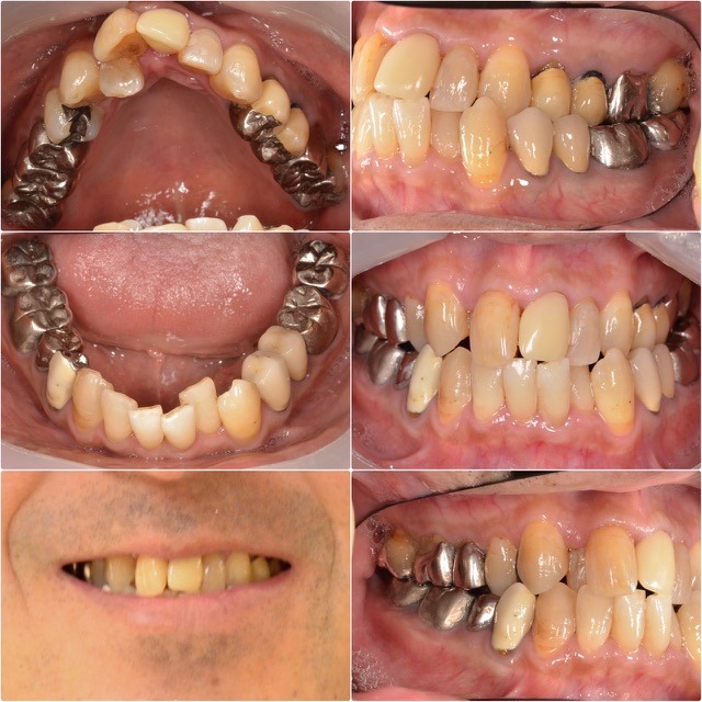 歯並びを改善したい2025.10.24