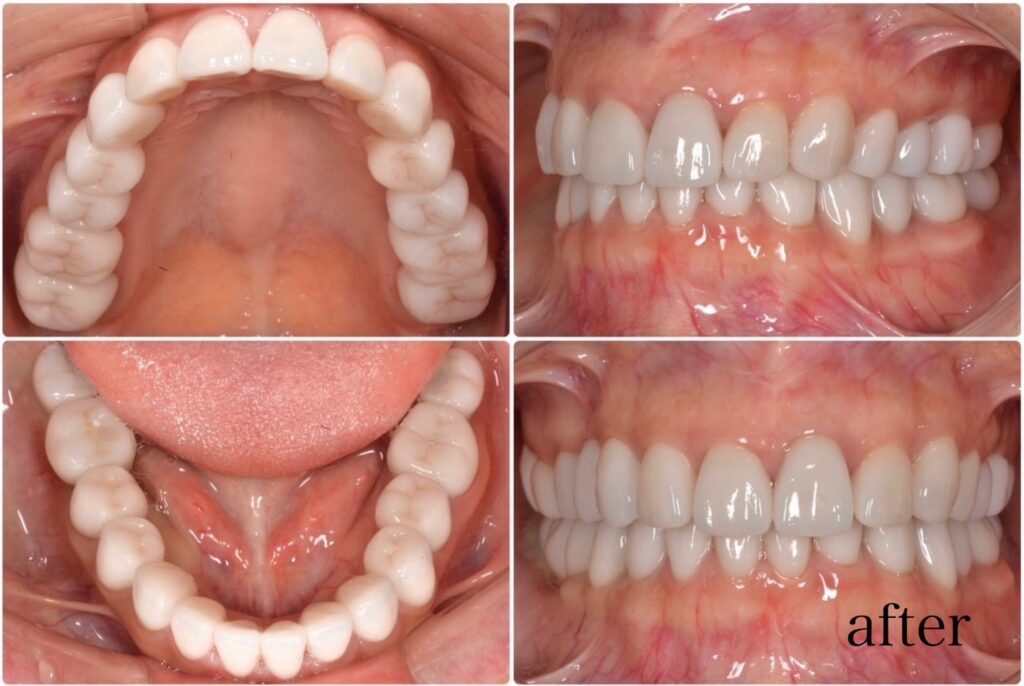 透明感ケア 2025.11.05