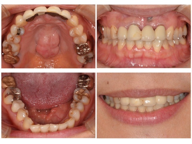 悪い所は全て治したい　60代女性　2025.11.7