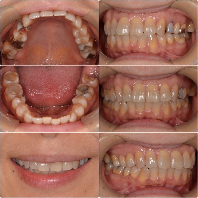 悪い所はすべて治したい2025.11.7